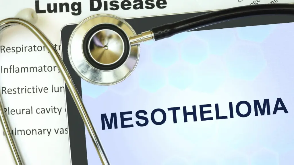 What Is a Mesothelioma Lawsuit? And How to File a Mesothelioma Lawsuit?